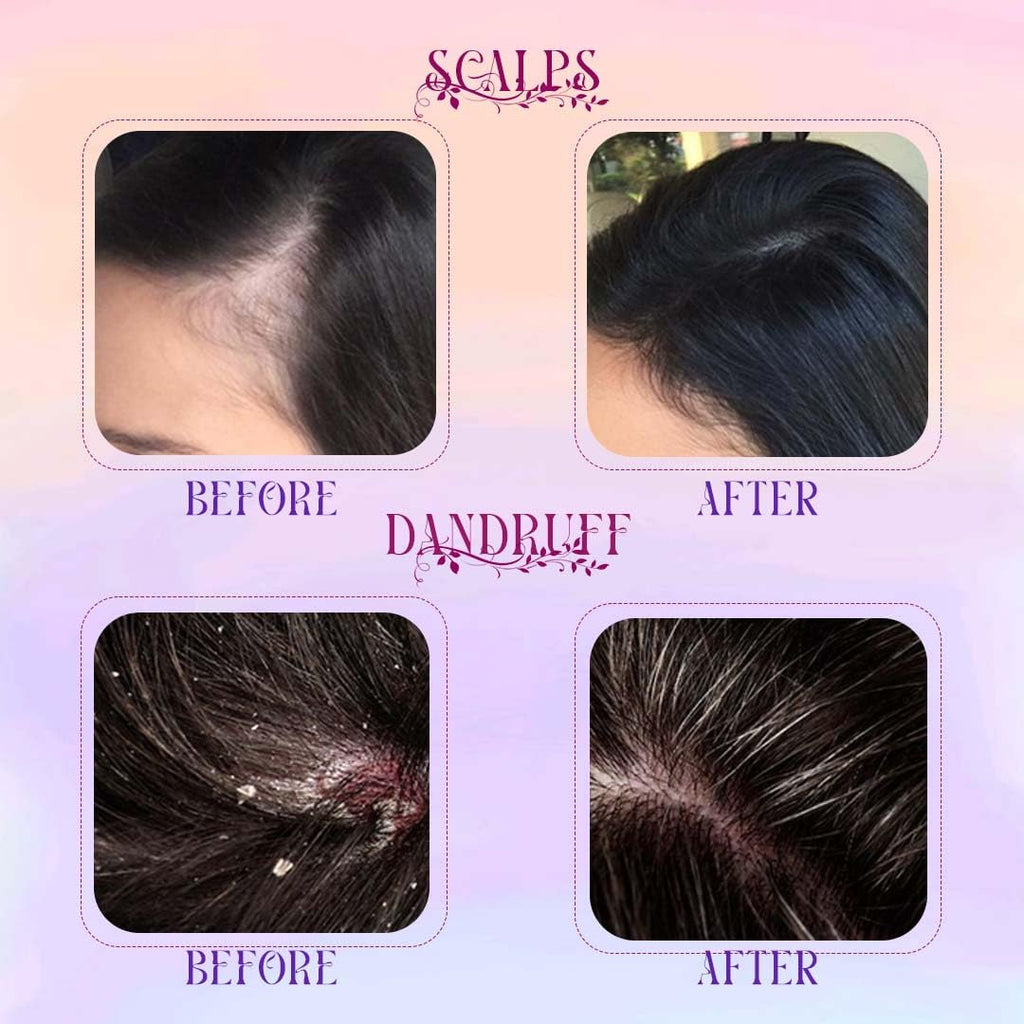 Rosemary Hair Water Spray Combo Pack