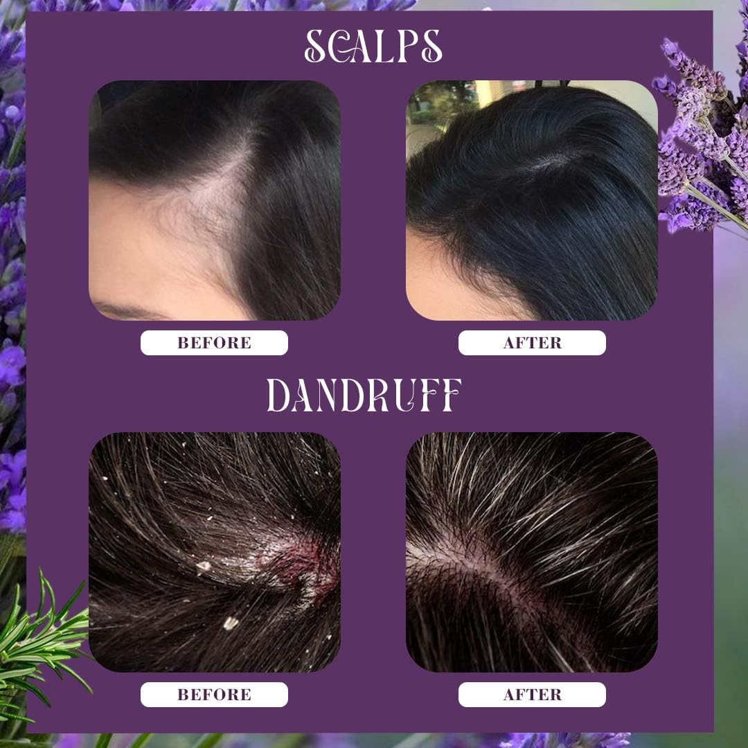 Rosemary Hair Water Spray Combo Pack