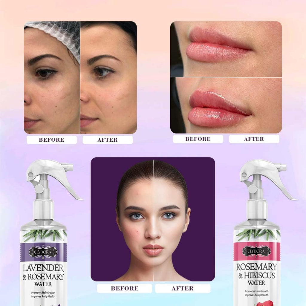 Rosemary Hair Water Spray Combo Pack