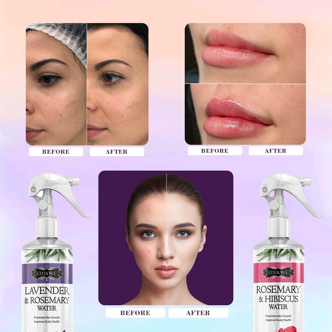 Rosemary Hair Water Spray Combo Pack